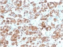 LH beta Mouse anti-Human, Clone: rLHb/1613, Novus Biologicals 100 &mu;g;
